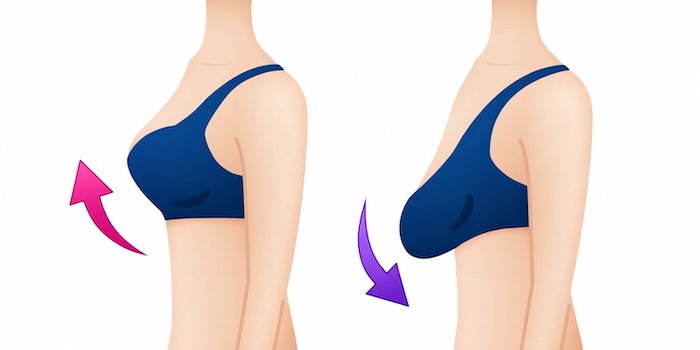 Áo ngực cho ngực chảy xệ