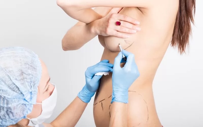 Có nên nâng ngực nội soi