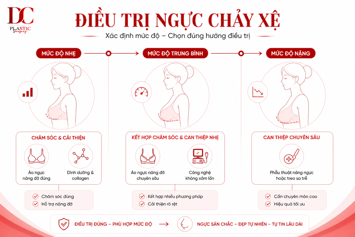 Điều trị ngực chảy xệ