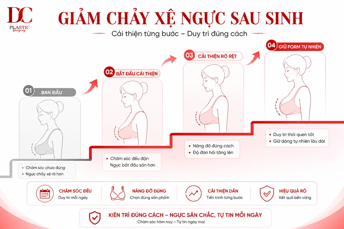 Giảm chảy xệ ngực sau sinh