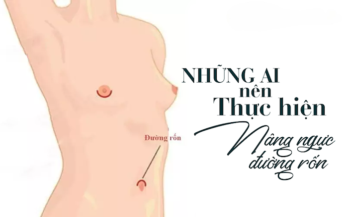 Nâng ngực nội soi qua đường rốn