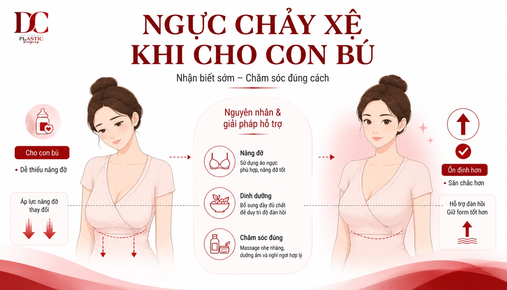 Ngực chảy xệ khi cho con bú