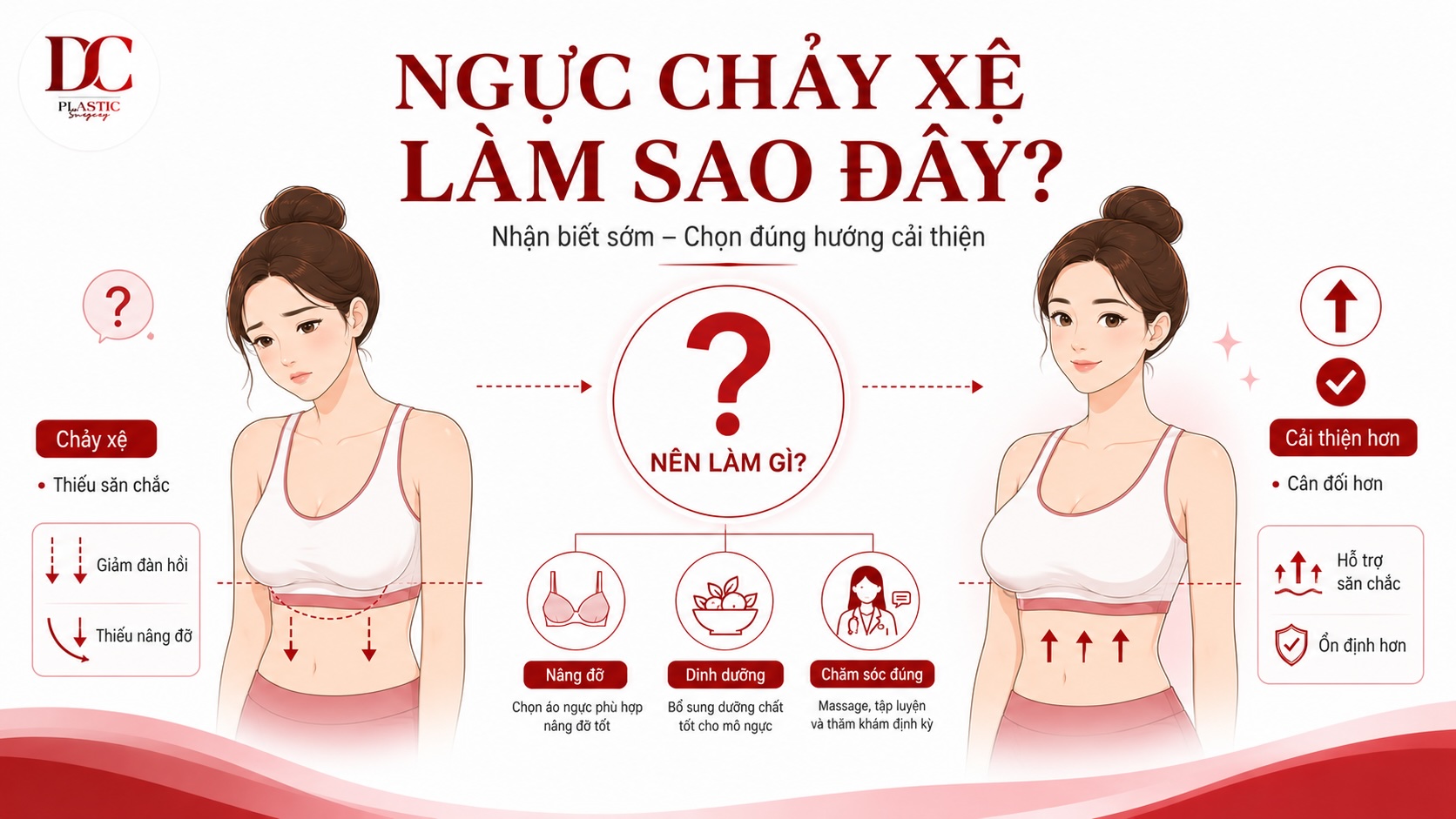 Ngực chảy xệ làm sao đây