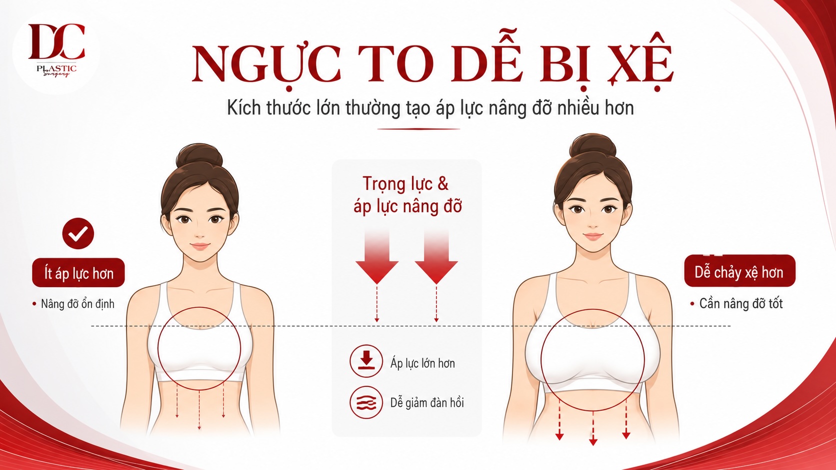 Ngực to dễ bị xệ