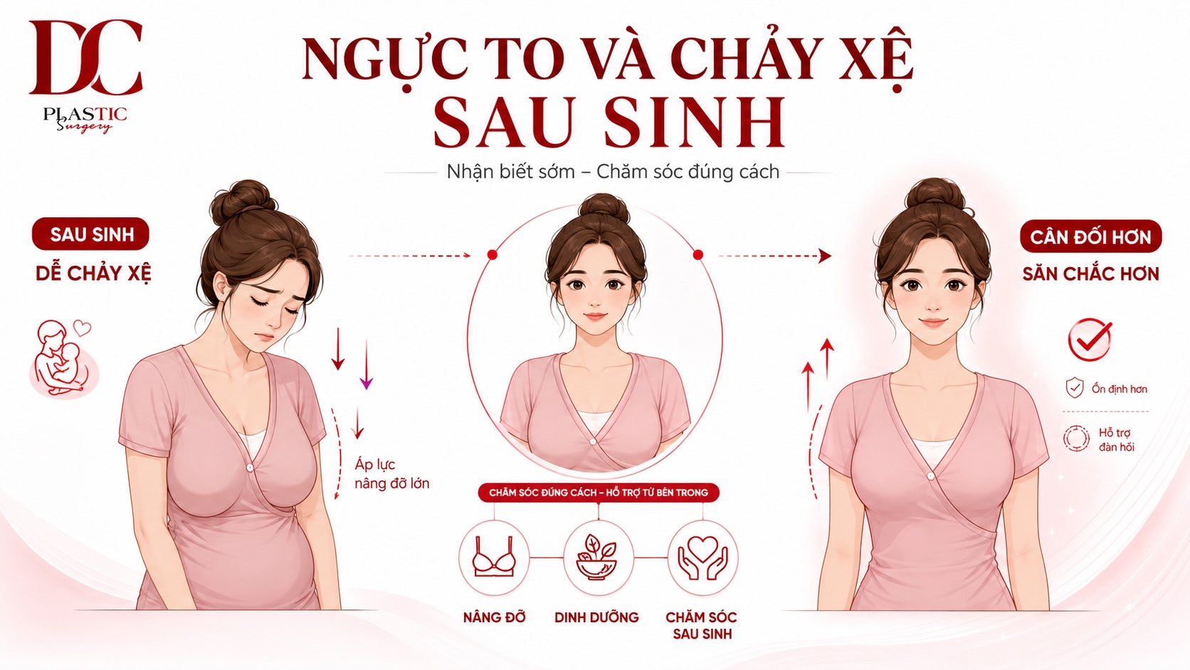 Ngực to và chảy xệ sau sinh