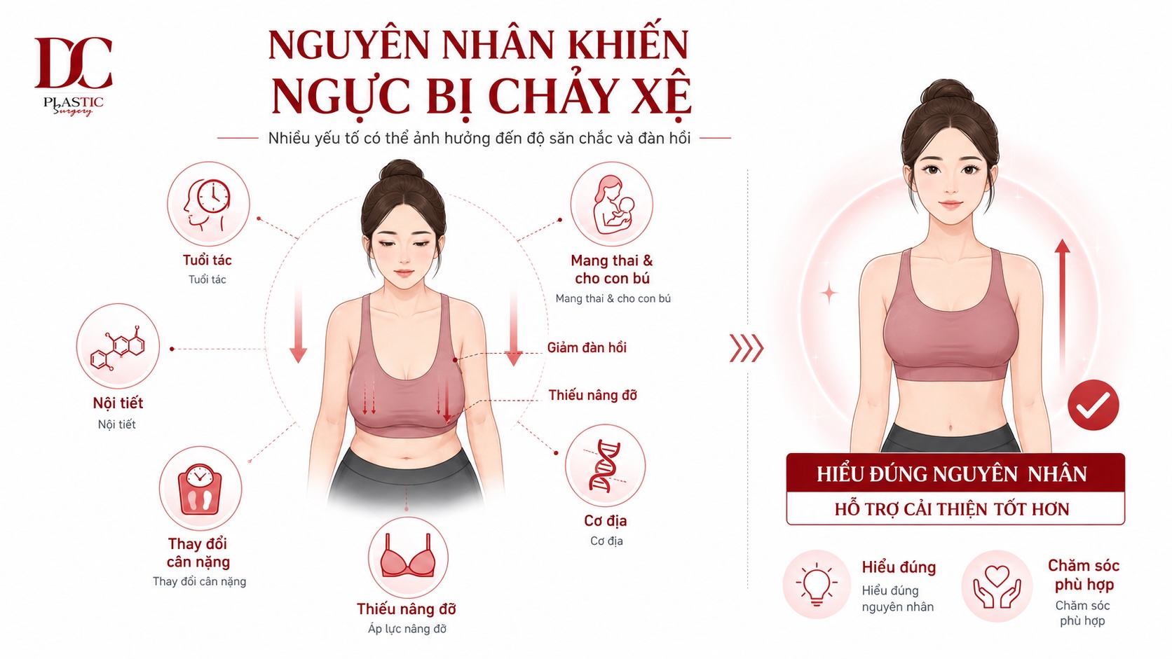 Nguyên nhân khiến ngực bị chảy xệ