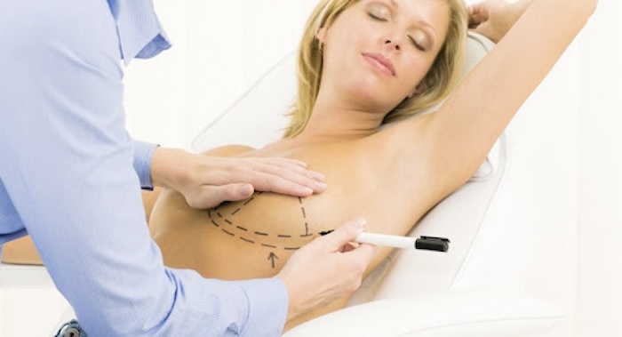 Phẫu thuật căng da ngực nội soi