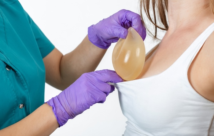 Phẫu thuật nâng ngực nội soi hết bao nhiêu tiền