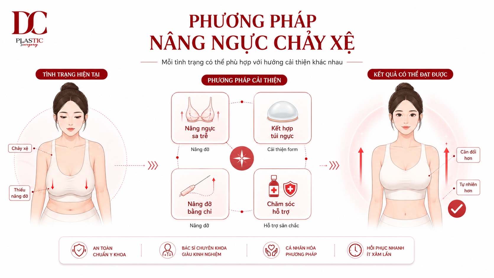 Phương pháp nâng ngực chảy xệ Phương pháp nâng ngực chảy xệ