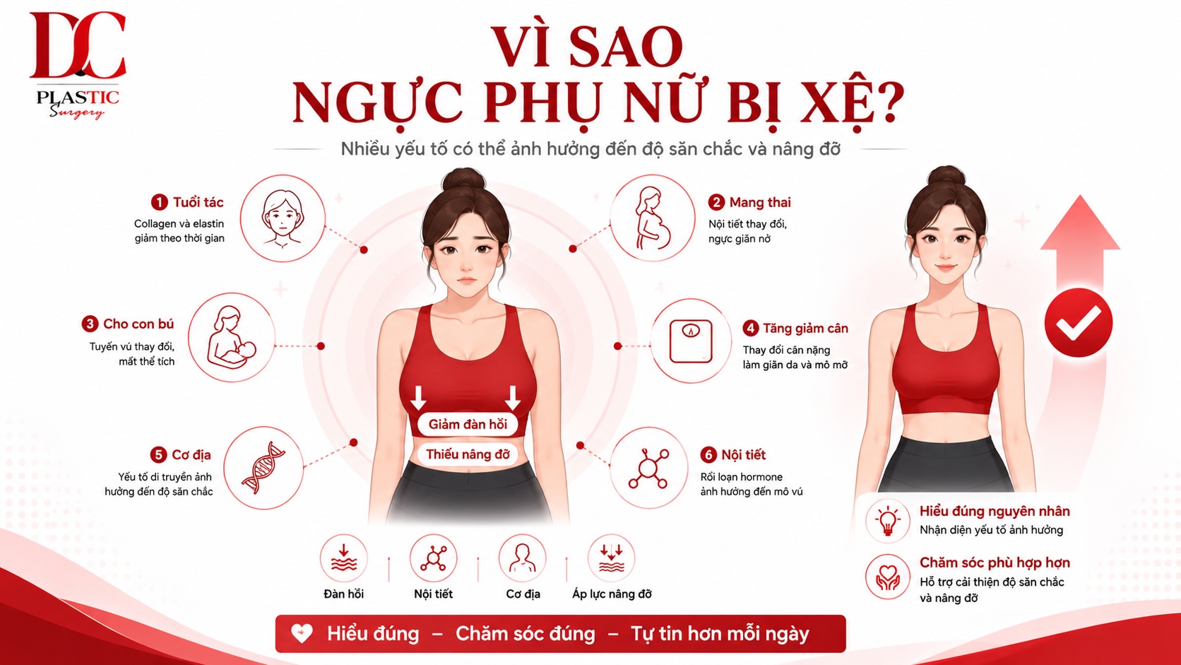 Vì sao ngực phụ nữ bị xệ Vì sao ngực phụ nữ bị xệ