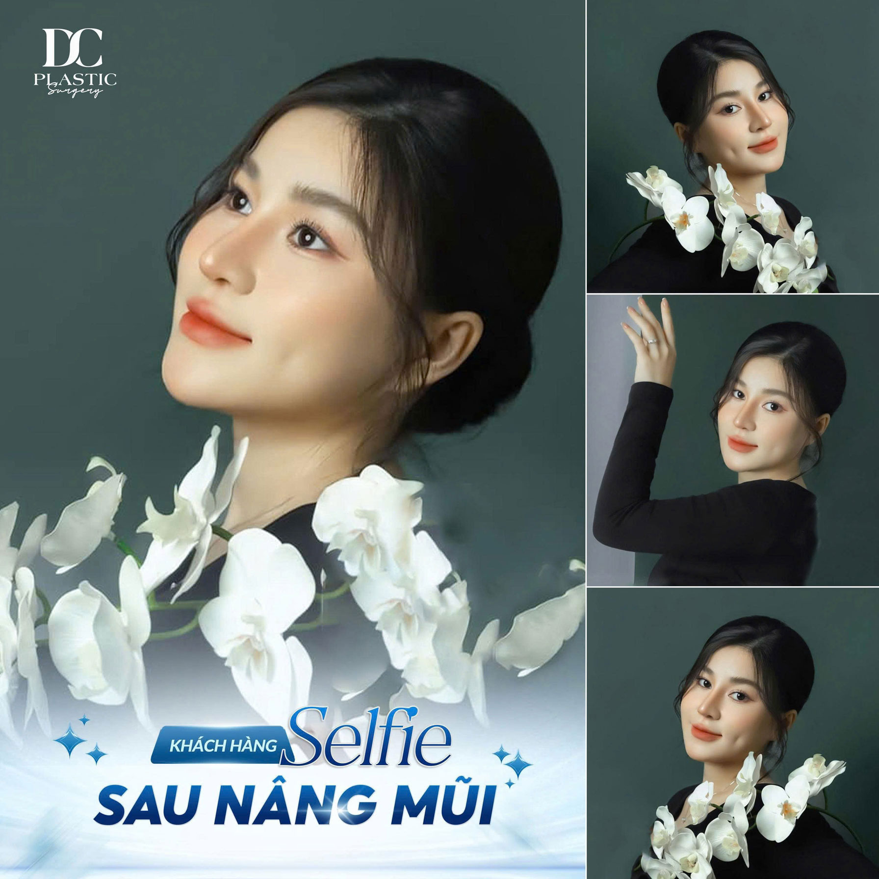 Selfie mũi 1