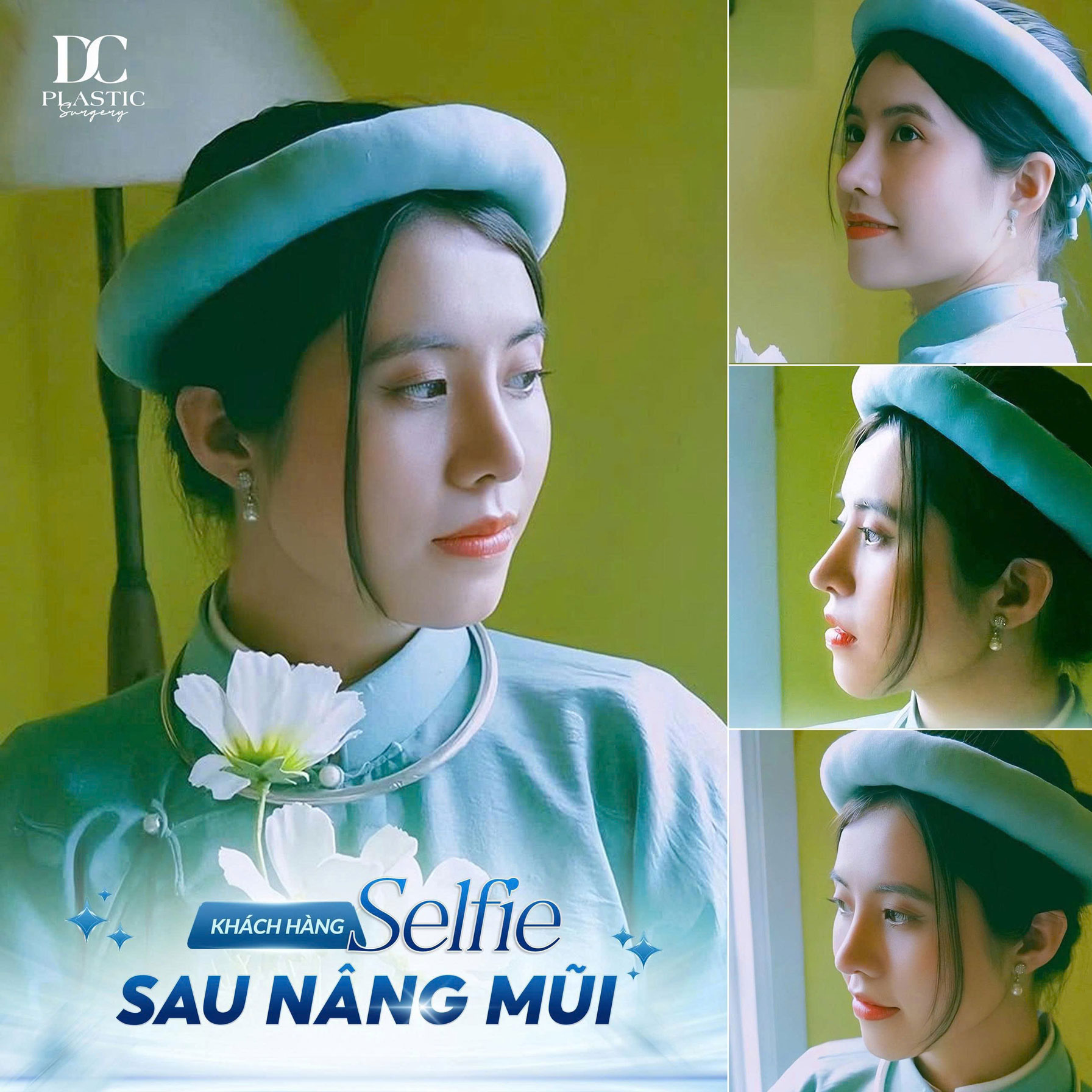 Selfie mũi 2